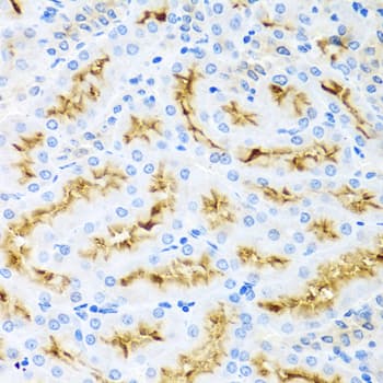 CCL22 / MDC Antibody