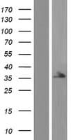 STRADA / LYK5 Protein (Over-Expression Lysate Myc-DDK (Flag))