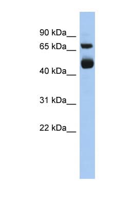 Polyclonal Rabbit anti-Human ALOX15 / 15-Lipoxygenase Antibody (aa539-588, WB)