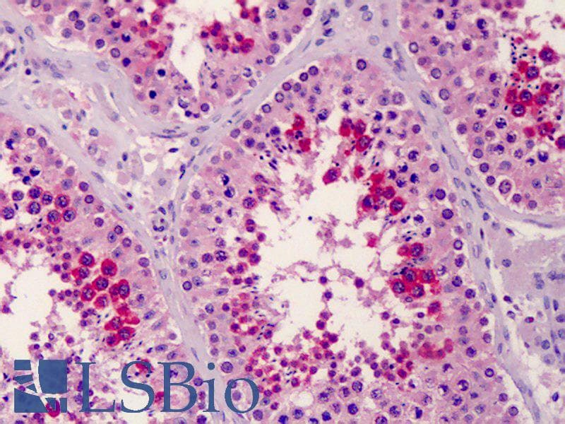 IHC-plus™ Polyclonal Rabbit anti-Human SLC35D1 Antibody (IHC, WB)