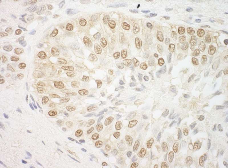 Polyclonal Rabbit anti-Human ARID3B Antibody (aa100-150, IHC)