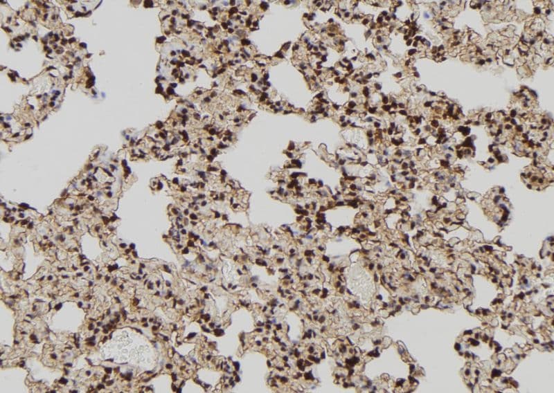 Polyclonal Rabbit anti-Human TIA-1 Antibody (IHC, IF, WB)