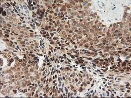 PDXK / PNK Antibody (clone OTI3G2)