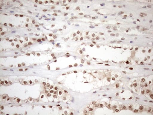 MGMT Antibody (clone OTI6C4)