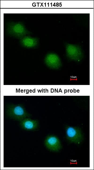Polyclonal Rabbit anti-Human UBQLN1 / Ubiquilin Antibody (aa64-345, WB)