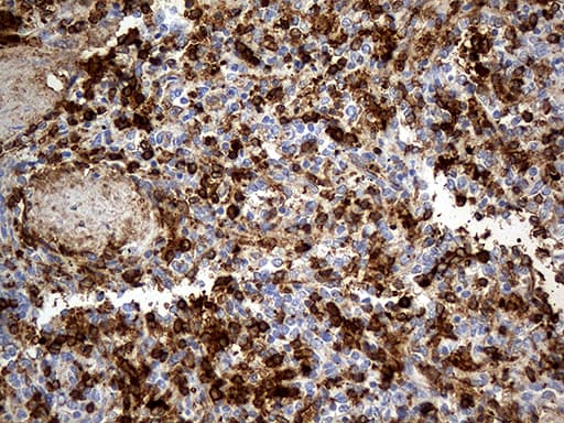 ACE / CD143 Antibody (aa642-1230, clone OTI2C8)