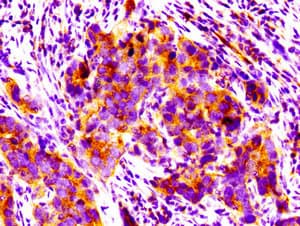 Polyclonal Rabbit anti-Human PPM1F Antibody (IHC, IF, WB)