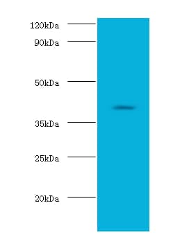 ADH2 / ADH1B Antibody (Biotin)