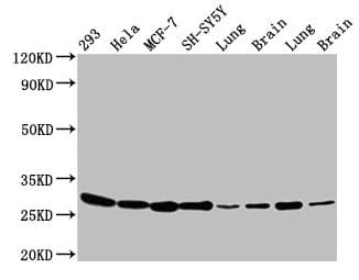IHC-plus™ BCAP31 / BAP31 Antibody (aa 2-234)