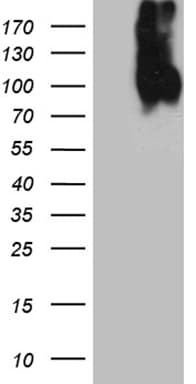 LAMP1 / CD107a Antibody (aa29-382, clone OTI10E1)