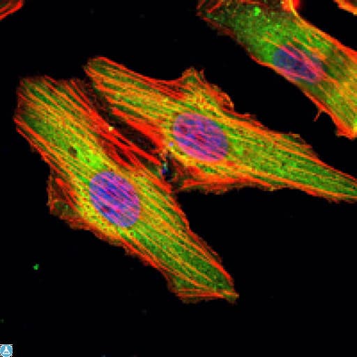 MATN1 / Matrilin 1 Antibody