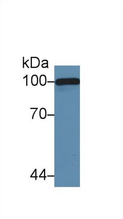 Complement C5a Antibody (aa679-755)