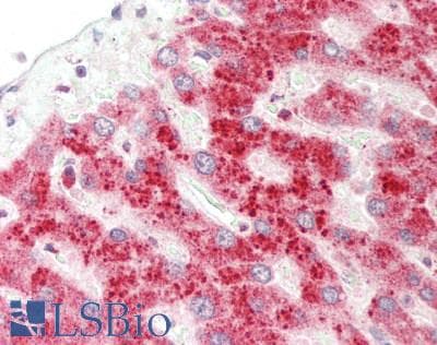 IHC-plus™ LRAT Antibody (aa89-138)