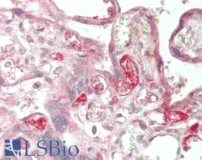 IHC-plus™ EDN1 / Endothelin 1 Antibody (aa53-90)