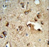 Polyclonal Rabbit anti-Human TSPAN1 / TM4SF Antibody (aa140-167, IHC, WB)