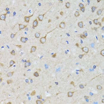 TOLLIP Antibody