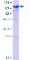 Human LTA4H / LTA4 Protein (Recombinant GST)