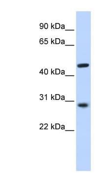 Polyclonal Rabbit anti-Human PYGO2 / Pygopus 2 Antibody (N-Terminus, WB)