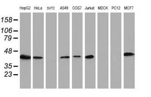 ARFGAP1 Antibody (clone OTI1F9)