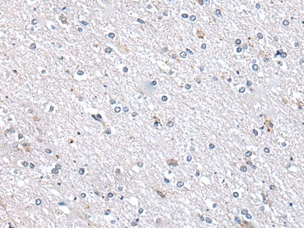 Polyclonal Rabbit anti-Human METTL7A Antibody (IHC)