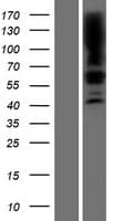 SGPL1 Protein (Over-Expression Lysate Myc-DDK (Flag))