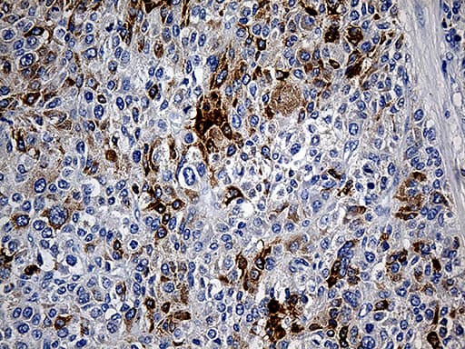 Monoclonal Mouse anti-Human TFF1 / pS2 Antibody (clone OTI1A4, aa25-84, IHC, WB)