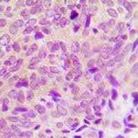 PTP1B Antibody (N-Terminus)