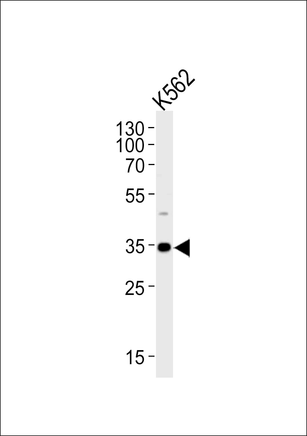 BBS5 Antibody (aa108-141)