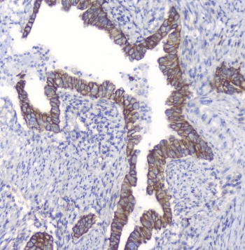 PRKCB / PKC-Beta Antibody