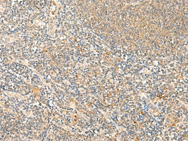 IP6K3 Antibody