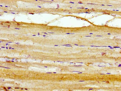 AKIP1 / BCA3 Antibody