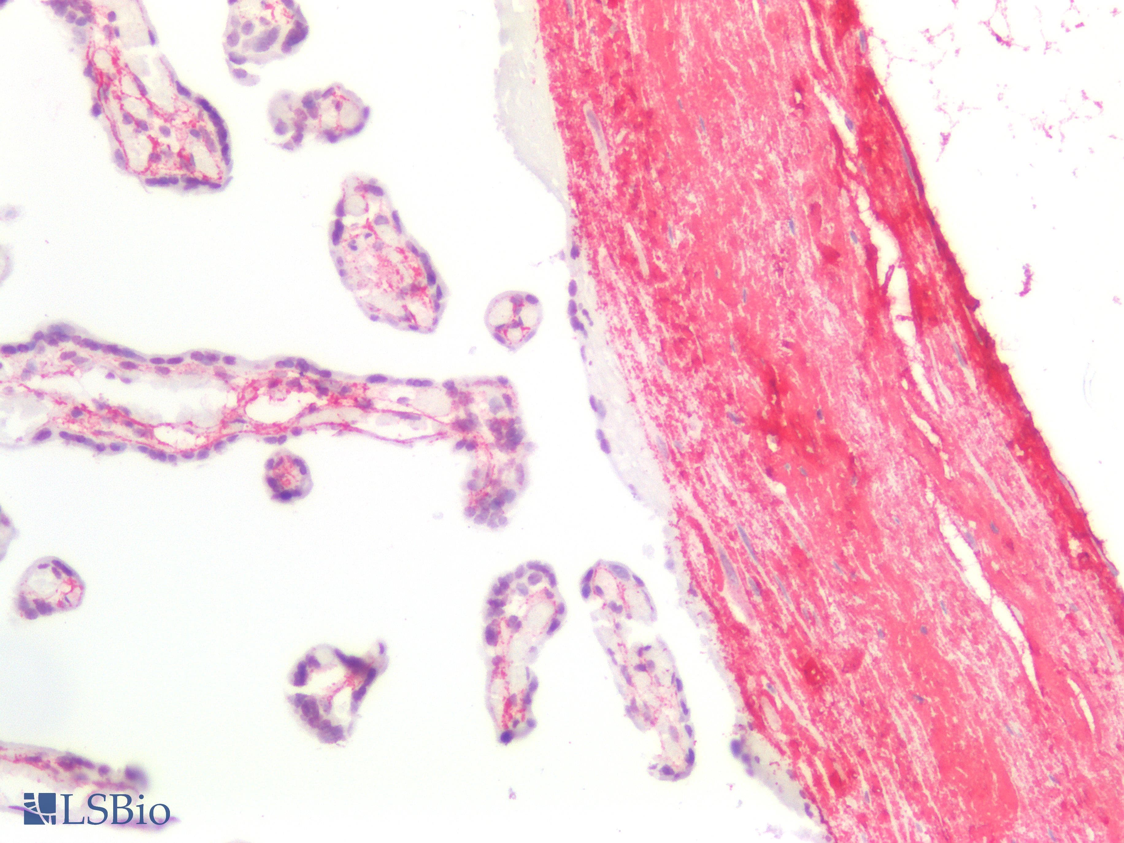 CTx-I Antibody