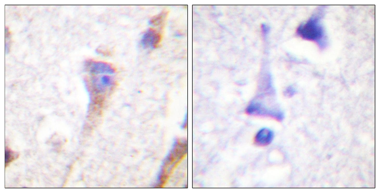 Polyclonal Rabbit anti-Human PRKD1 / PKC Mu Antibody (p463, IHC, WB)