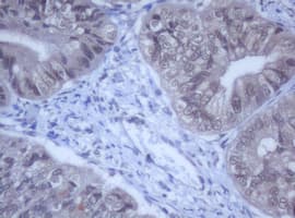 Monoclonal Mouse anti-Human DDX59 Antibody (clone OTI2G1, IHC, WB)