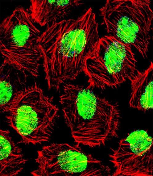 NCL / Nucleolin Antibody (aa276-304)