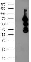 KATNB1 Antibody (clone OTI1A3)