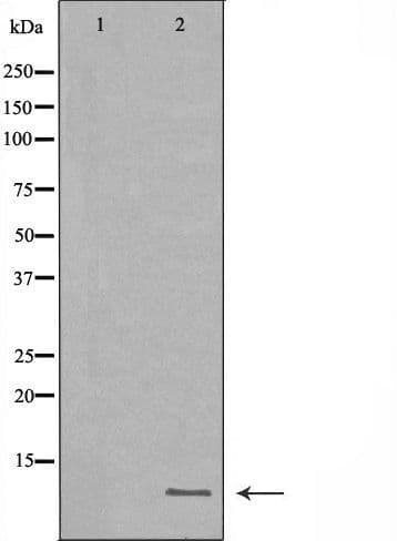 Polyclonal Rabbit anti-Human HAMP / Hepcidin Antibody (IHC, WB)