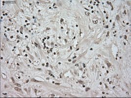 NTRK3 / TRKC Antibody (clone OTI2B8)
