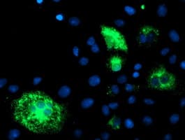 DHFRL1 Antibody (aa4-185, clone OTI1E2)