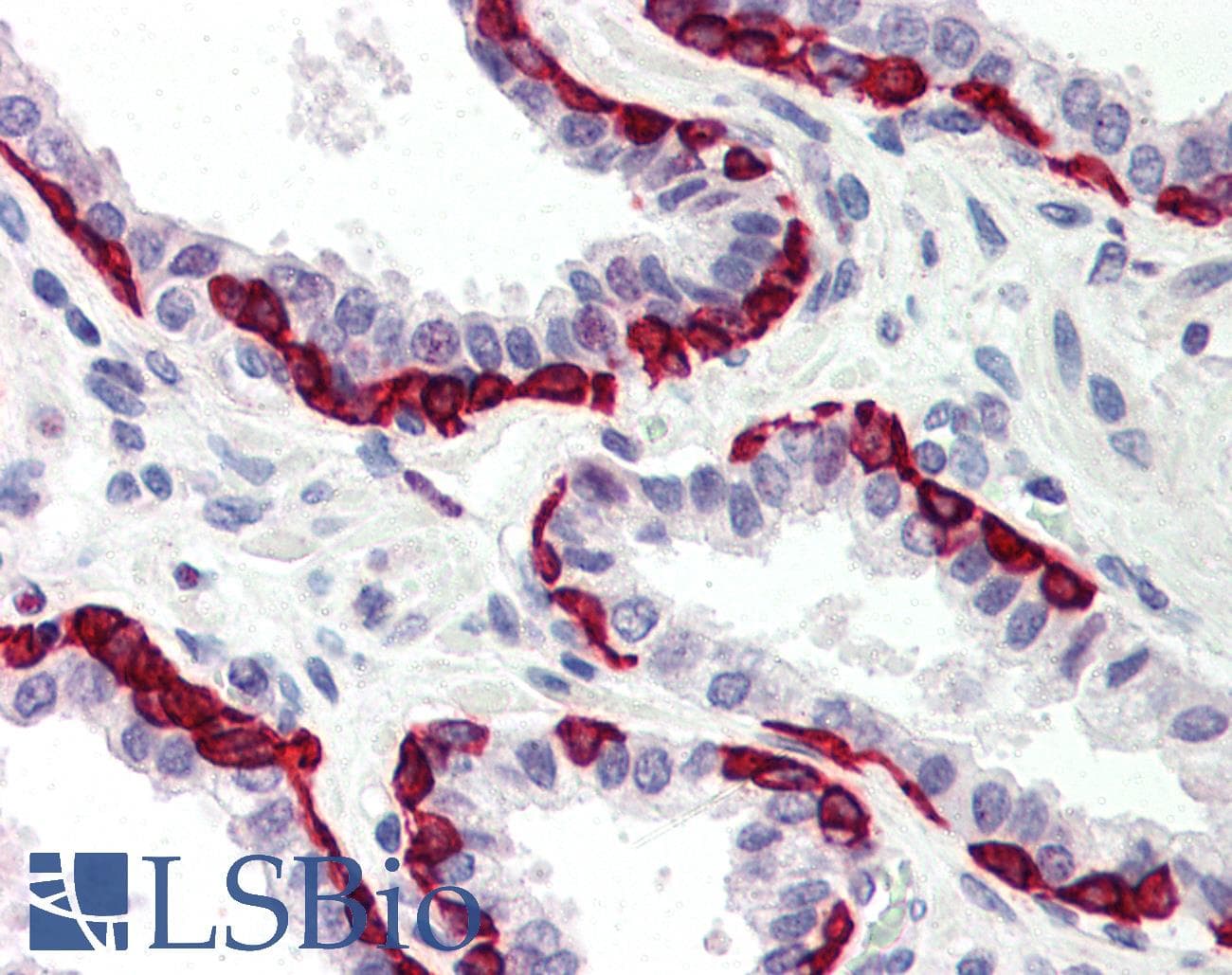 IHC-plus™ Polyclonal Rabbit anti-Human DAPK2 / DAP Kinase 2 Antibody (IHC, WB)