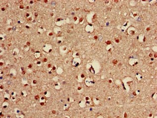 Polyclonal Rabbit anti-Human ABCA2 Antibody (IHC)