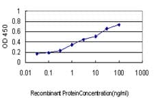 AURKA / Aurora-A Antibody (aa1-111, clone 5F8)