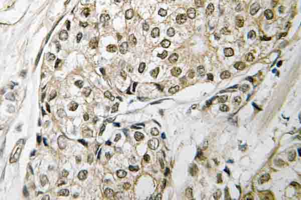 RB1 / Retinoblastoma / RB Antibody (Thr601)