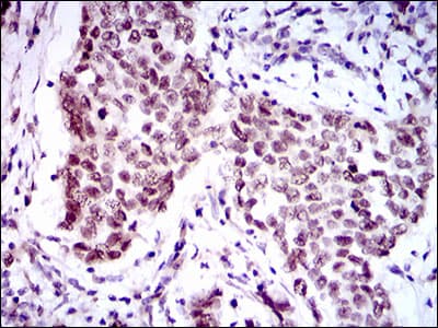 FOXP1 Antibody (clone 6E4)