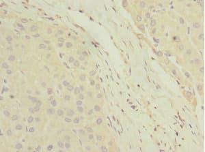 DHAND / HAND2 Antibody