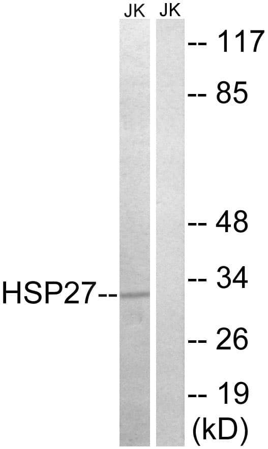 IHC-plus™ HSPB1 / HSP27 Antibody (aa45-94)