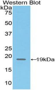 ADGRE5 / CD97 Antibody (aa32-173)