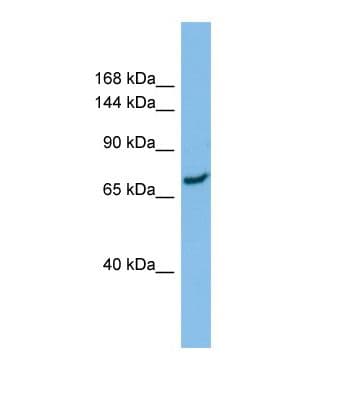 Polyclonal Rabbit anti-Human SLC8A1 / NCX1 Antibody (aa46-95, WB)