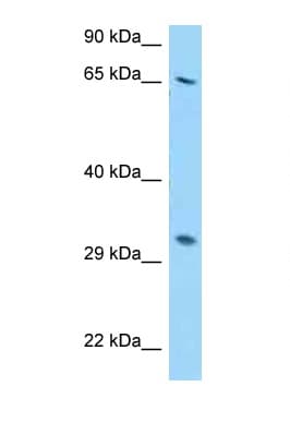 RPS2 / Ribosomal Protein S2 Antibody (aa46-95)