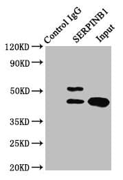 SERPINB1 Antibody (aa1-379)